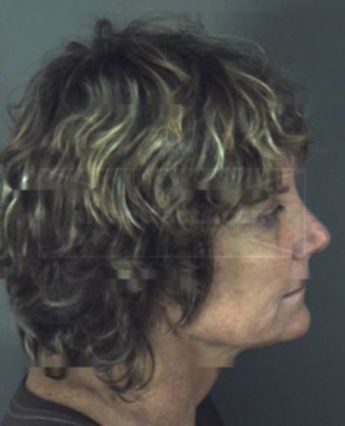 Joan Steverson Slade
