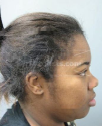 Mikeisha Mitchell
