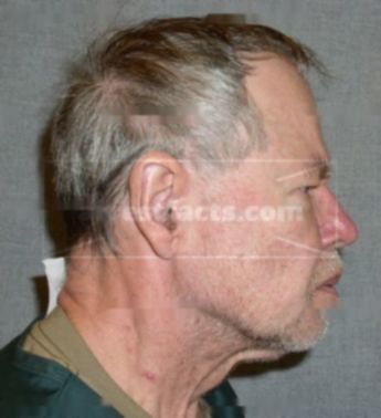 Wayne A Waldmann