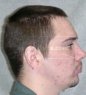 Matthew D Paulson