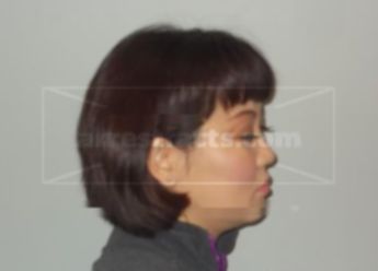 Ling J Yan