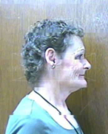 Cathleen L Pollard