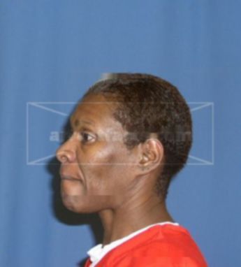Lucinda P Forney