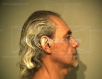 Gilbert Torres Trevino