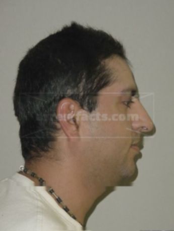 Oscar Caballero Hernandez