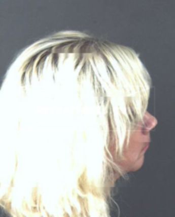 Rebecca Lices Brainard