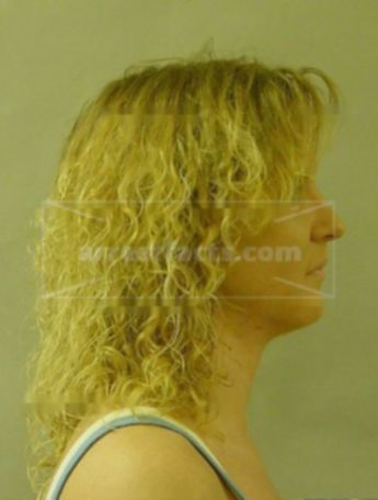Cynthia A Buechler