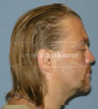 Ronald W Drost Jr.