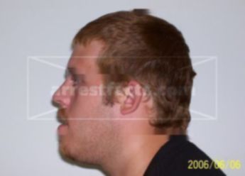 Kristopher R Ehlen