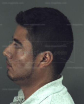 Gilberto Arturo Martinez
