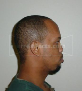 Steven D Burnside