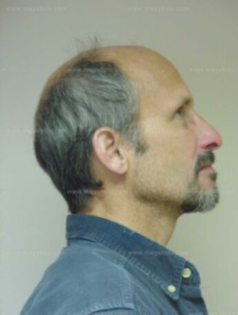 Paul M Engel