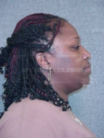 Valerie J Causey