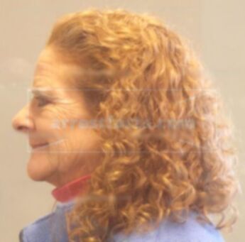 Doreen L Adcock