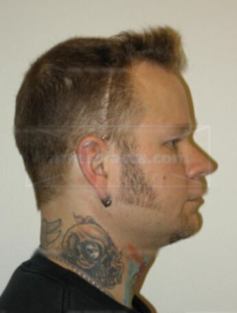 Scott D Deibert