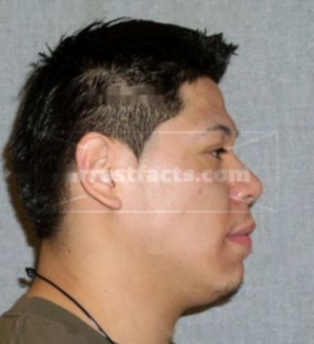 Miguel Anthony Esqueda