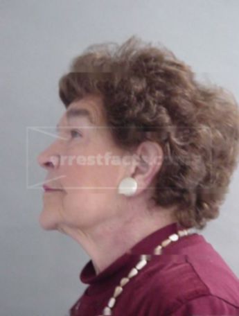 Grace L Kranig