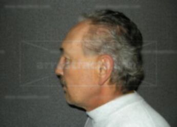 Michael J Lablance