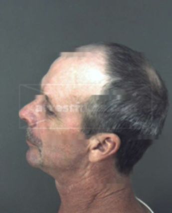 Scott Allen Riley