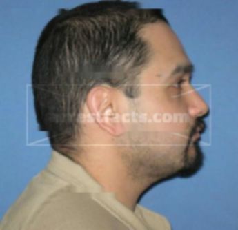 Luis Irizarry