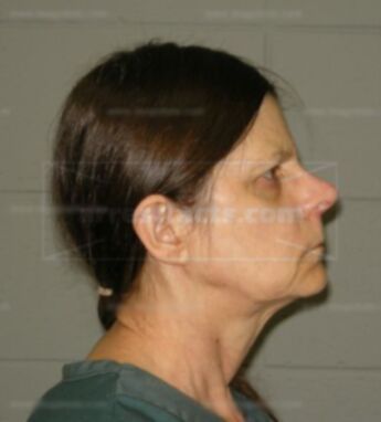 Laurel C Koker