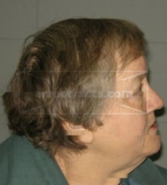 Lynda L Thillemann