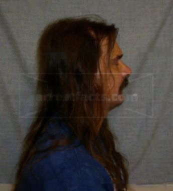 Tony L Gadicke