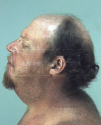 Mike Allen Roberts