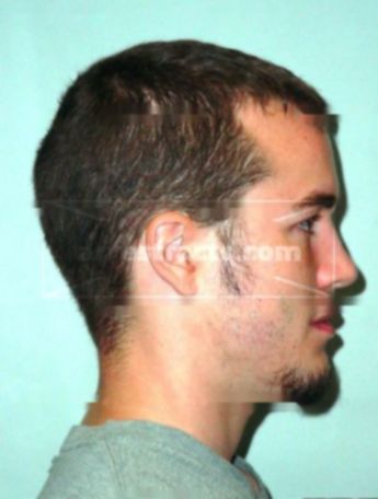 Brian R Dubois