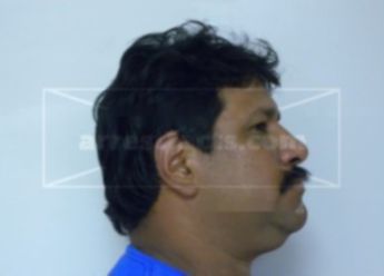 Yader G Ortiz