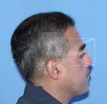 Gilbert Montoya