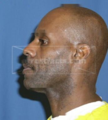 Melvin J Burns Sr.