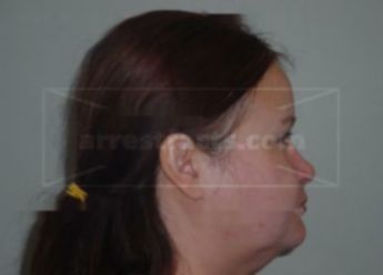 Suzie L Bombay