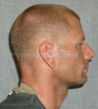 Todd K Weyher
