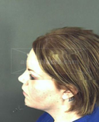 Lindsay Renee Melott