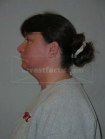Angela R Druckrey