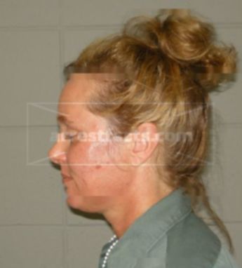 Kristi Schounard