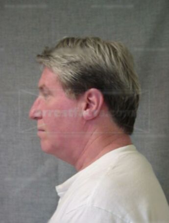 William D Reitzloff