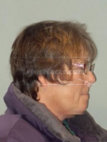 Rhonda J Krantz