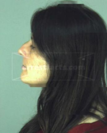 Alison Christine Briggs