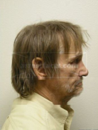 Robert L Gulan