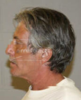 Joseph Anthony Dibuono