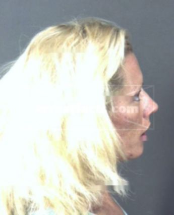 Amy Lynn Shaffer
