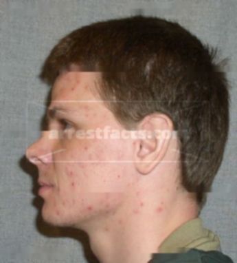 Jason Lobermeier