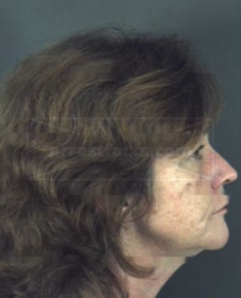 Kimberly Winters Bryant