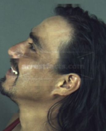 Miguel Nmn Hernandez