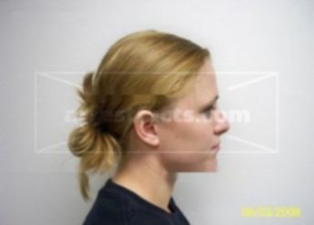 Rebecca A Peuker