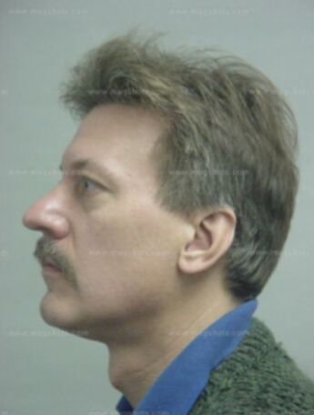 Brian P Doubek