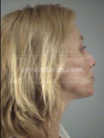 Erin Christine Royse