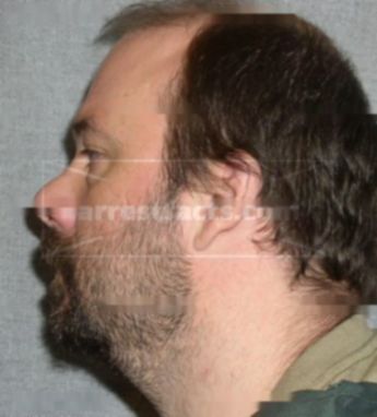 Jason Klein